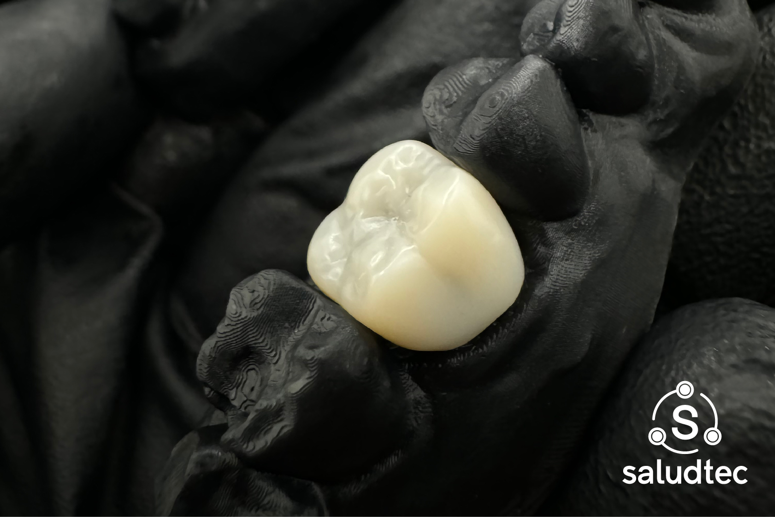 Innovación en Coronas Dentales con Tecnología 3D
