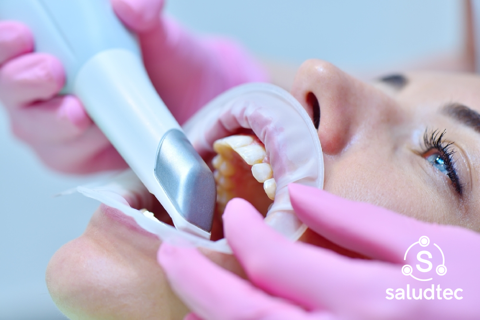 Las Ventajas del Escáner Intraoral en la Odontología: Precisión y Comodidad